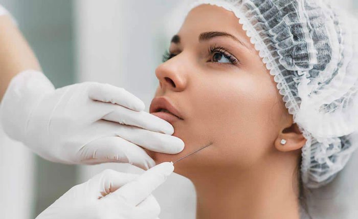 لیفت با نخ چیست و چطور انجام می شود؟