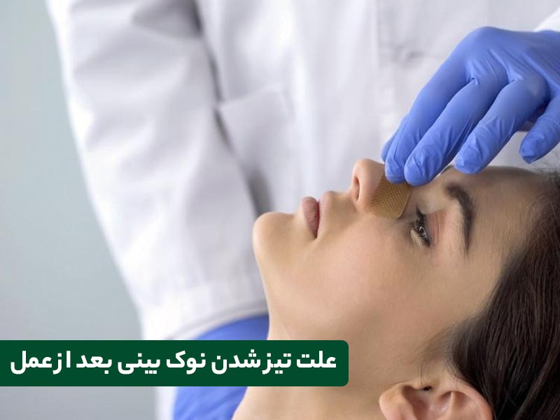 تیز شدن نوک بینی