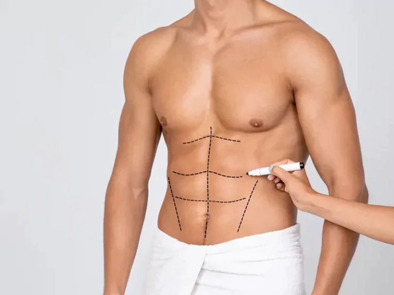 چگونه بهترین دکتر لیپوماتیک را انتخاب کنیم؟