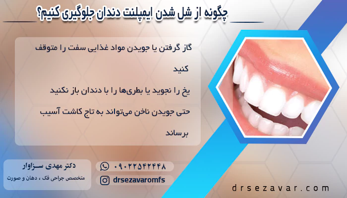 علت شل شدن ایمپلنت دندان و درمان آن