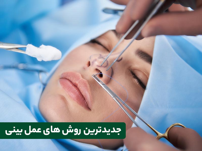 جدیدترین روش های عمل بینی