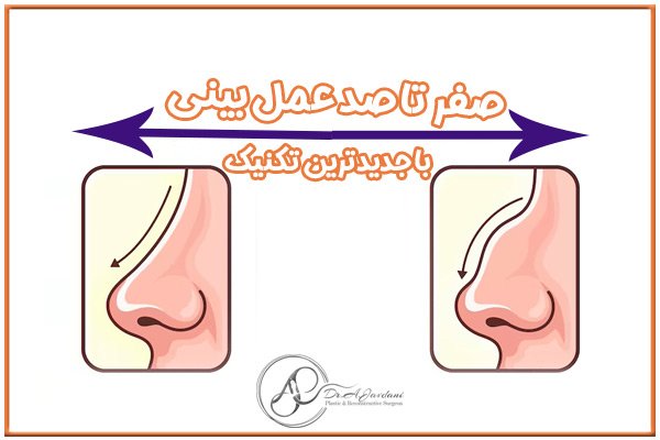جراحی بینی - دکتر جاودانی