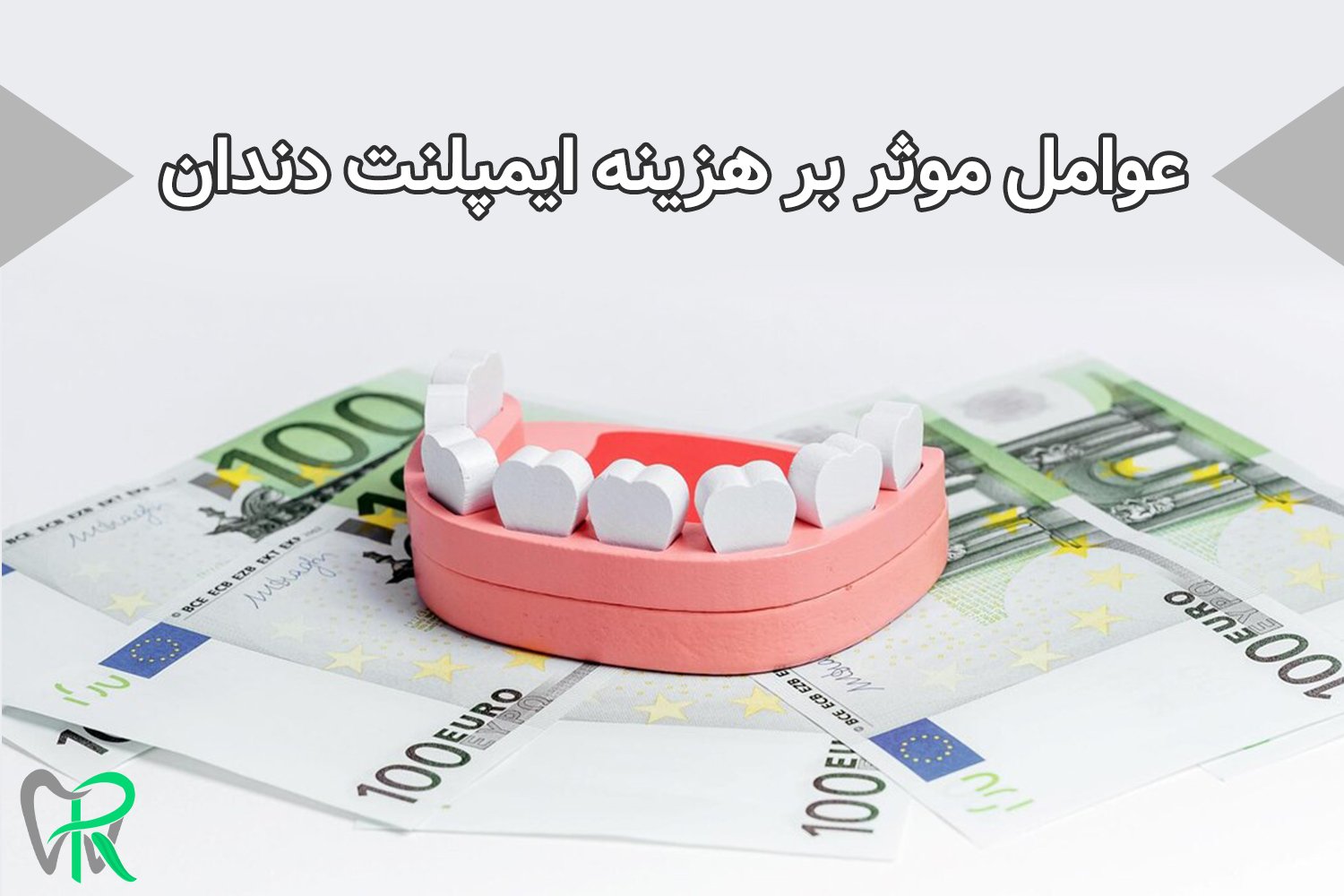 عوامل موثر بر قیمت ایمپلنت دندان