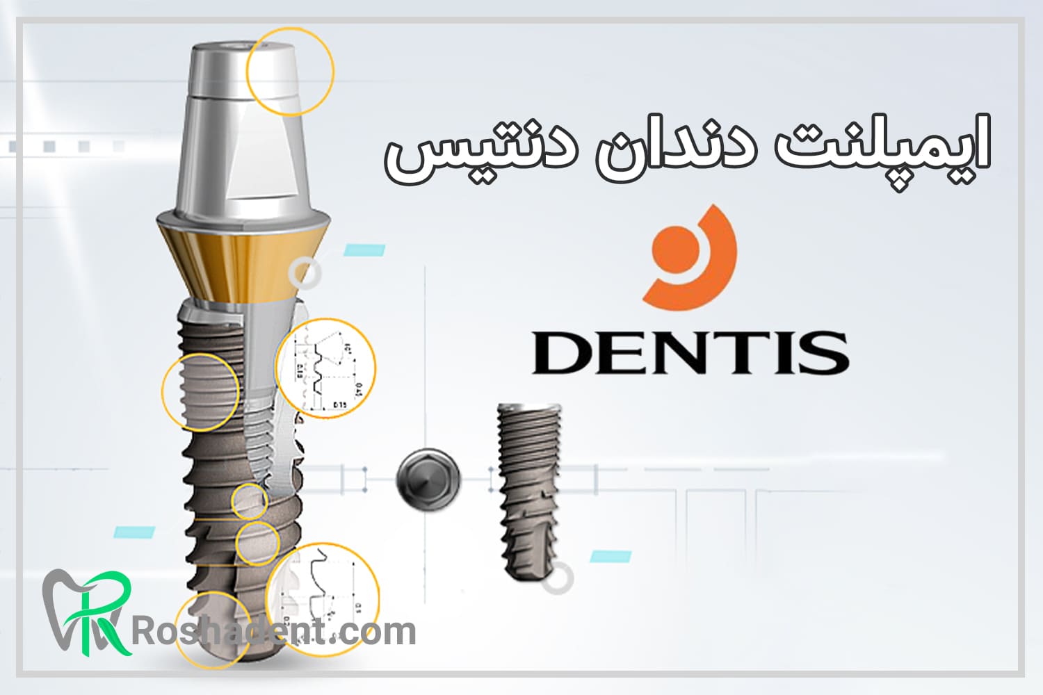 ایمپلنت دندان دنتیس