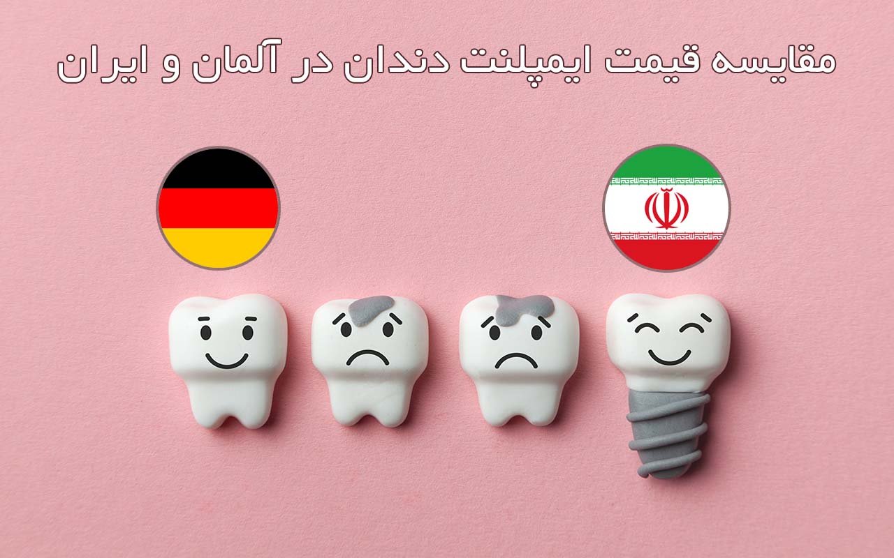 مقایسه قیمت ایمپلنت دندان در ایران و آلمان
