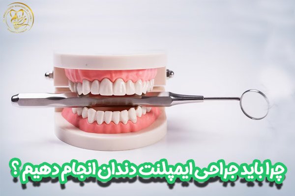 جراحی ایمپلنت دندان