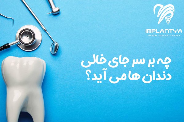 چه بر سر جای خالی دندان ها می آید؟-کلینیک ایمپلنتیا