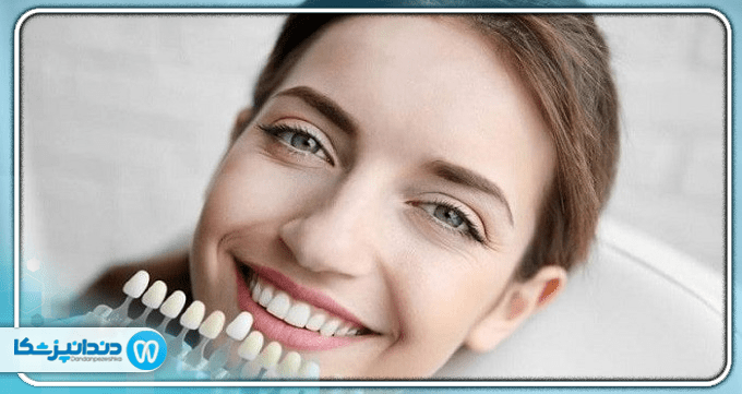 مزایای کامپوزیت دندانی