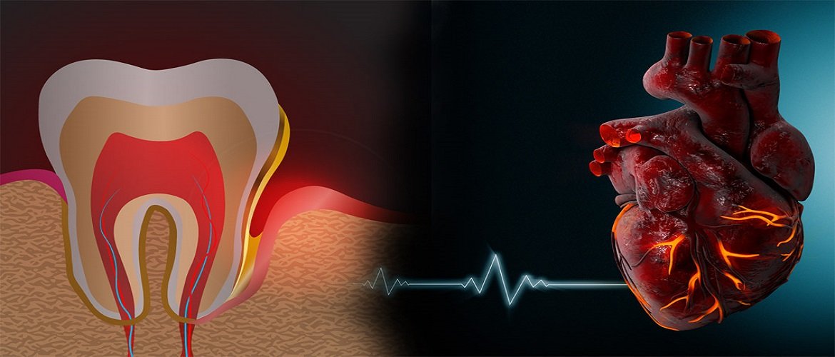 دندانپزشکی بیماران قلبی
