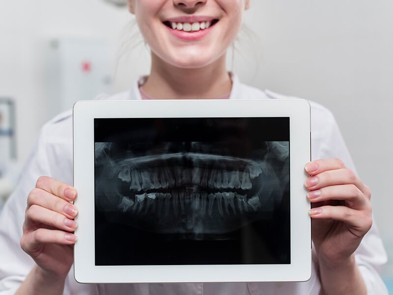 رادیوگرافی دیجیتالی دندان