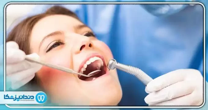 هزینه درمان های زیبایی دندانپزشکی چقدر است؟