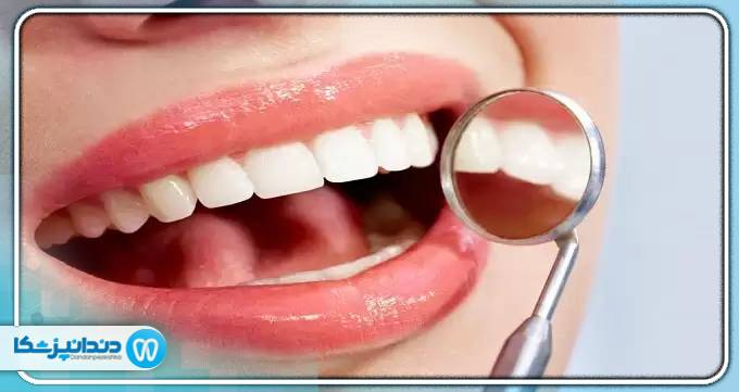 هزینه درمان های زیبایی دندانپزشکی چقدر است؟