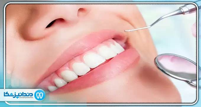 مهم ترین ویژگی های دندانپزشک زیبایی