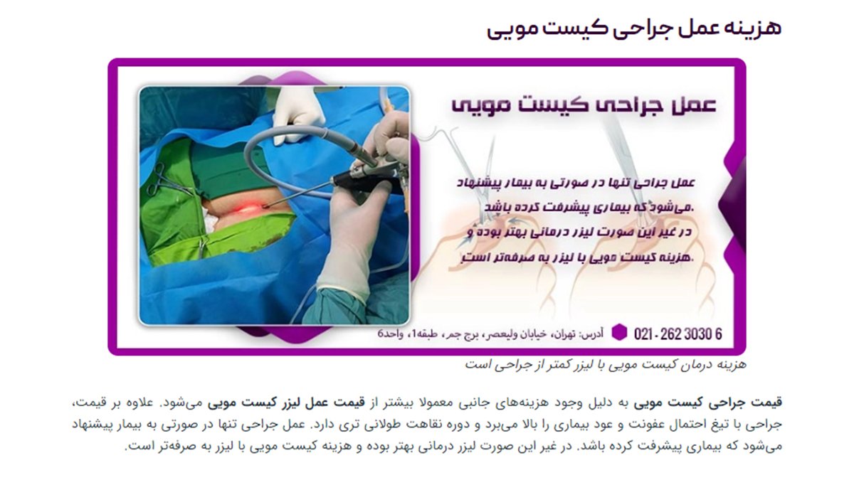 مقایسه هزینه لیزر کیست مویی با لیزر و جراح سنتی