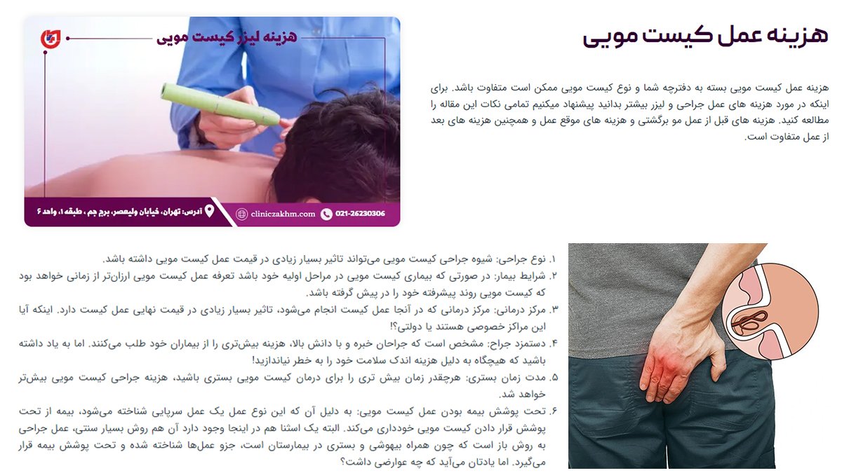 هزینه عمل لیزر کیست مویی در تهران