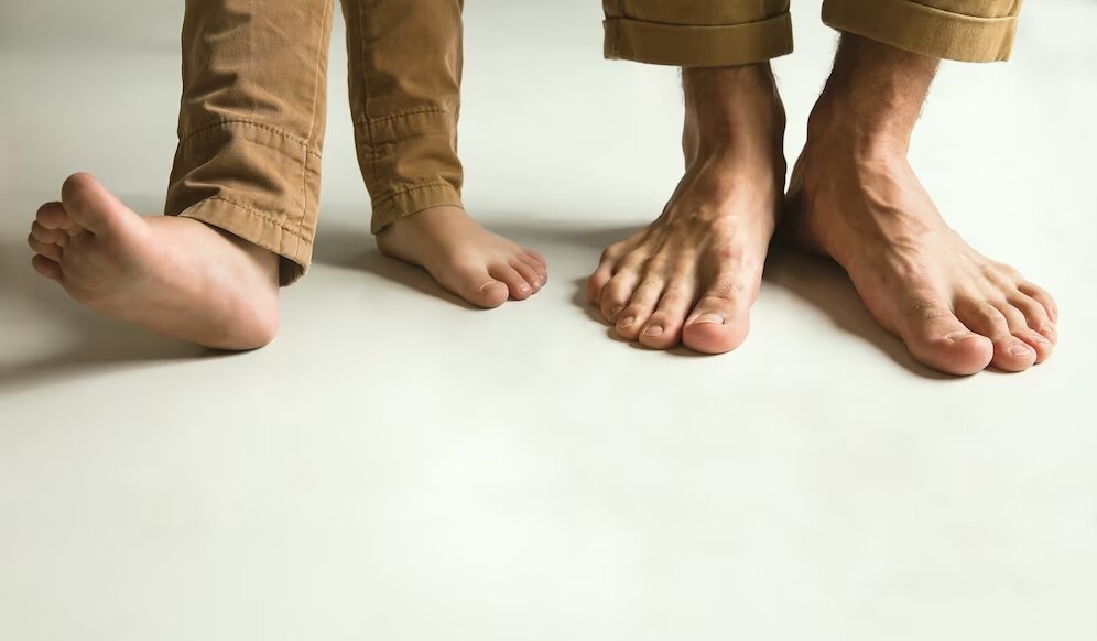 10 روش تشخیص کف پای صاف در کودکان و درمان قطعی