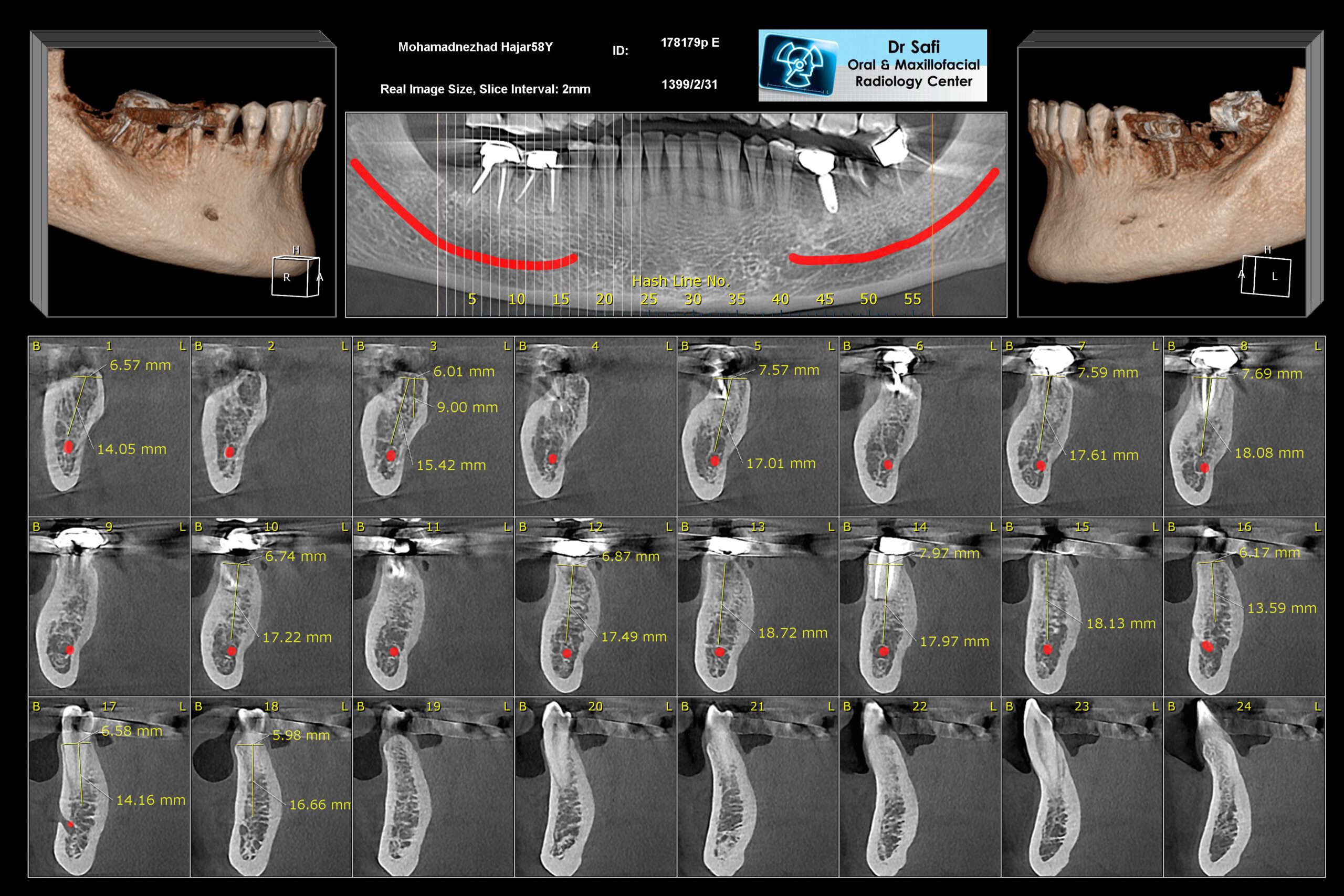 عکس cbct