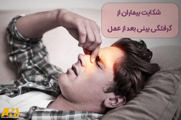 شکایت بیماران از گرفتگی بینی بعد از عمل