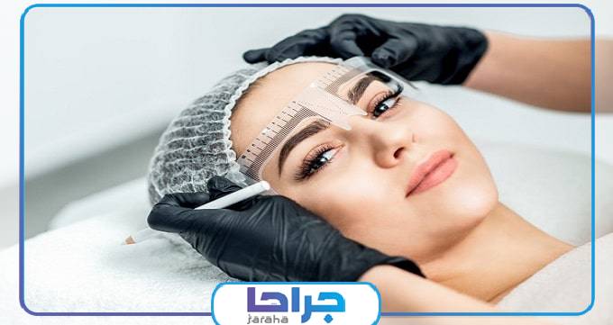 کاشت ابرو چیست؟