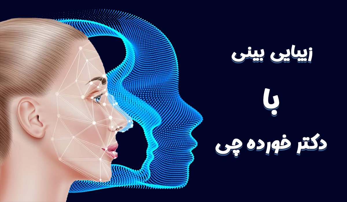 زیبایی بینی با دکتر خورده چی در اصفهان