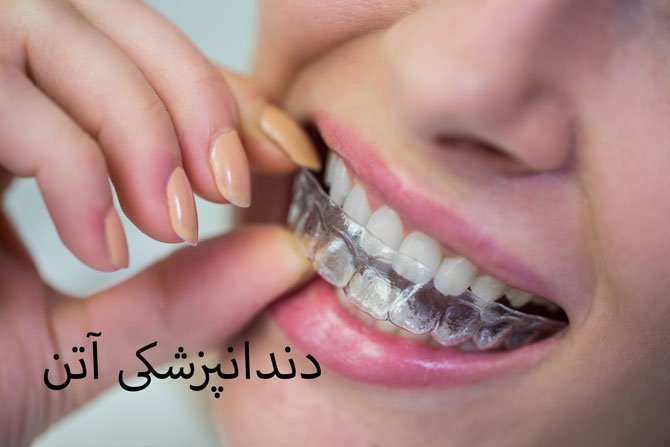بیماری لثه