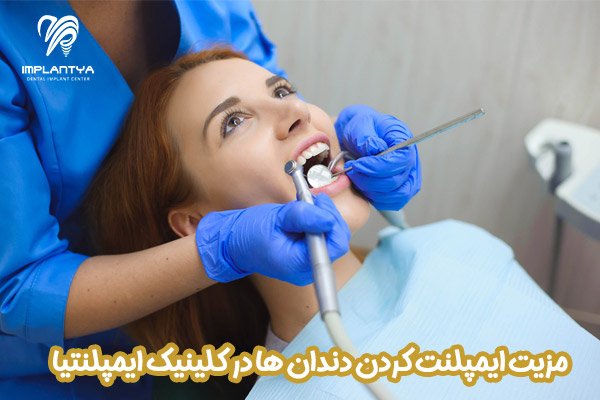 مزیت ایمپلنت کردن دندان ها در کلینیک ایمپلنتیا