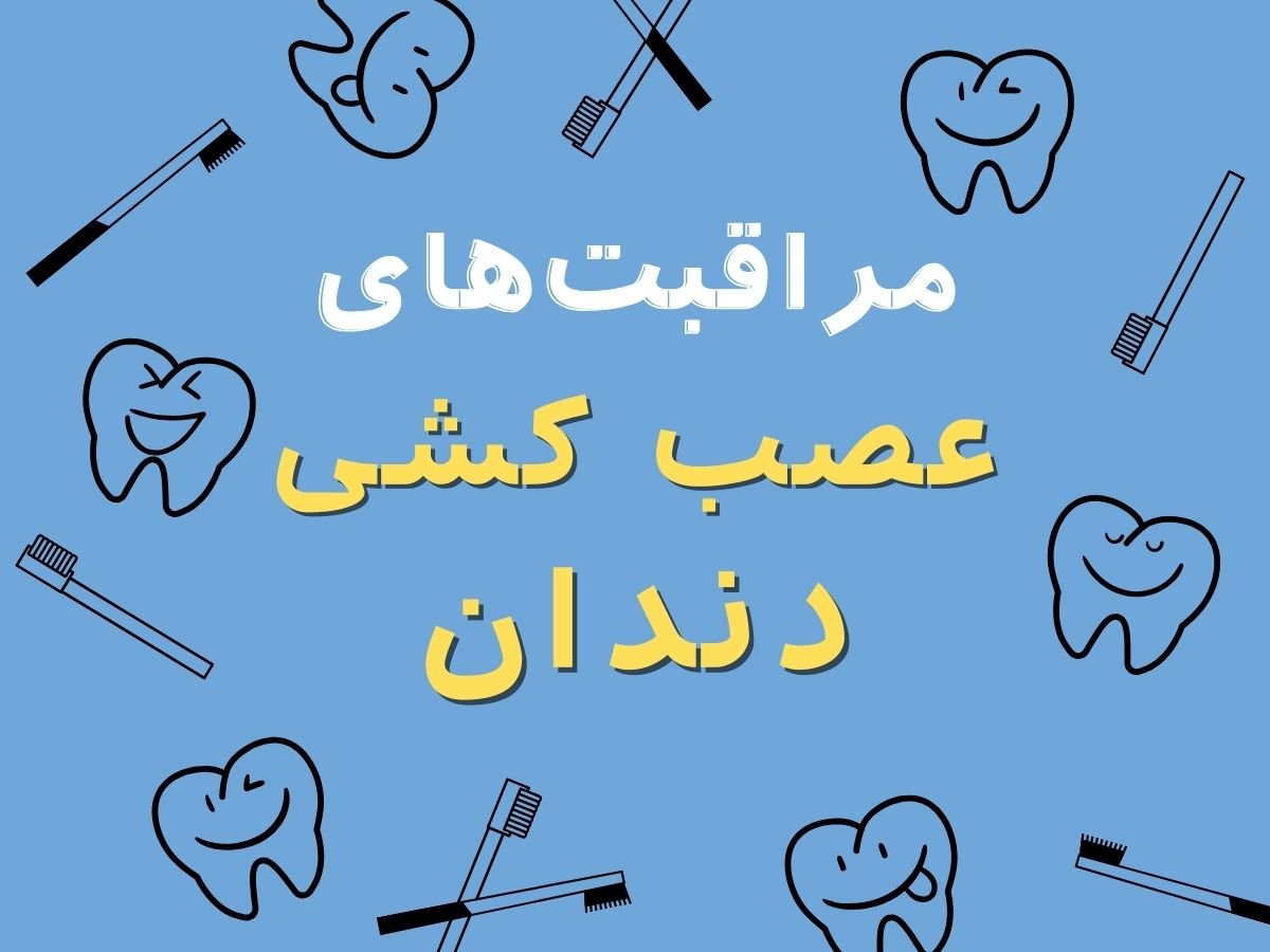 مراقبت عصب کشی