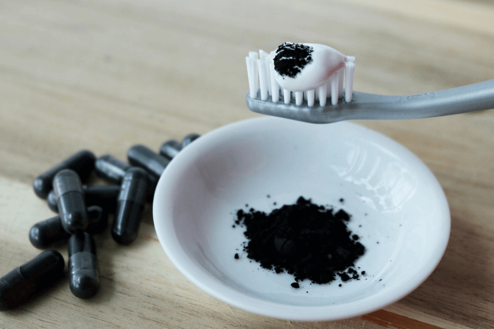 بهترین روش برای سفید کردن دندان در منزل