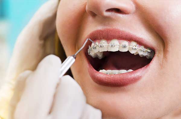جدیدترین روش های ارتودنسی دندان