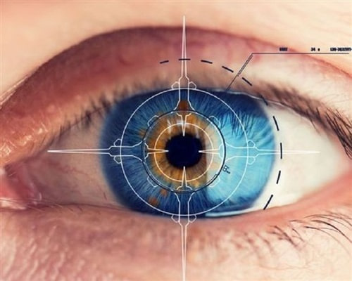 کدام عمل چشم برای شما مناسب‌تر است؟