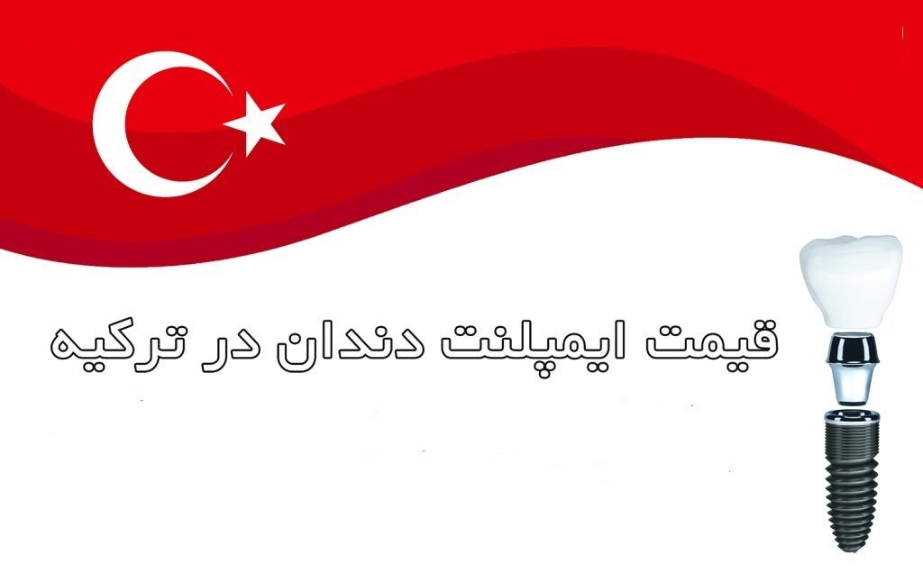 قیمت ایمپلنت در ترکیه