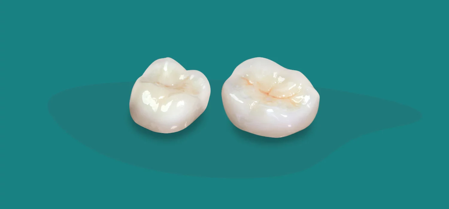 زیرکونیوم دندان چیست؟