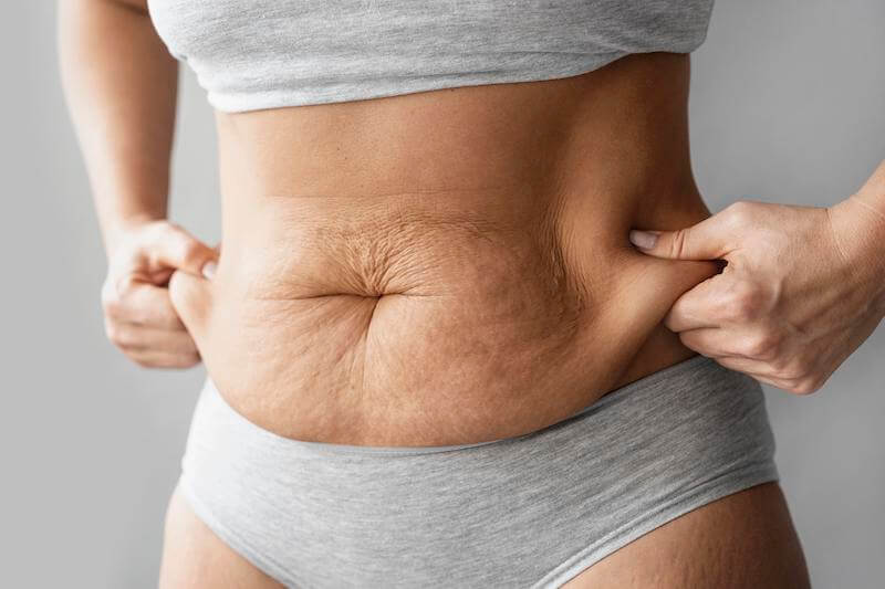 کیا از عمل ابدو پشیمونن؟! و چرا؟ کیا از عمل ابدو پشیمونن؟
