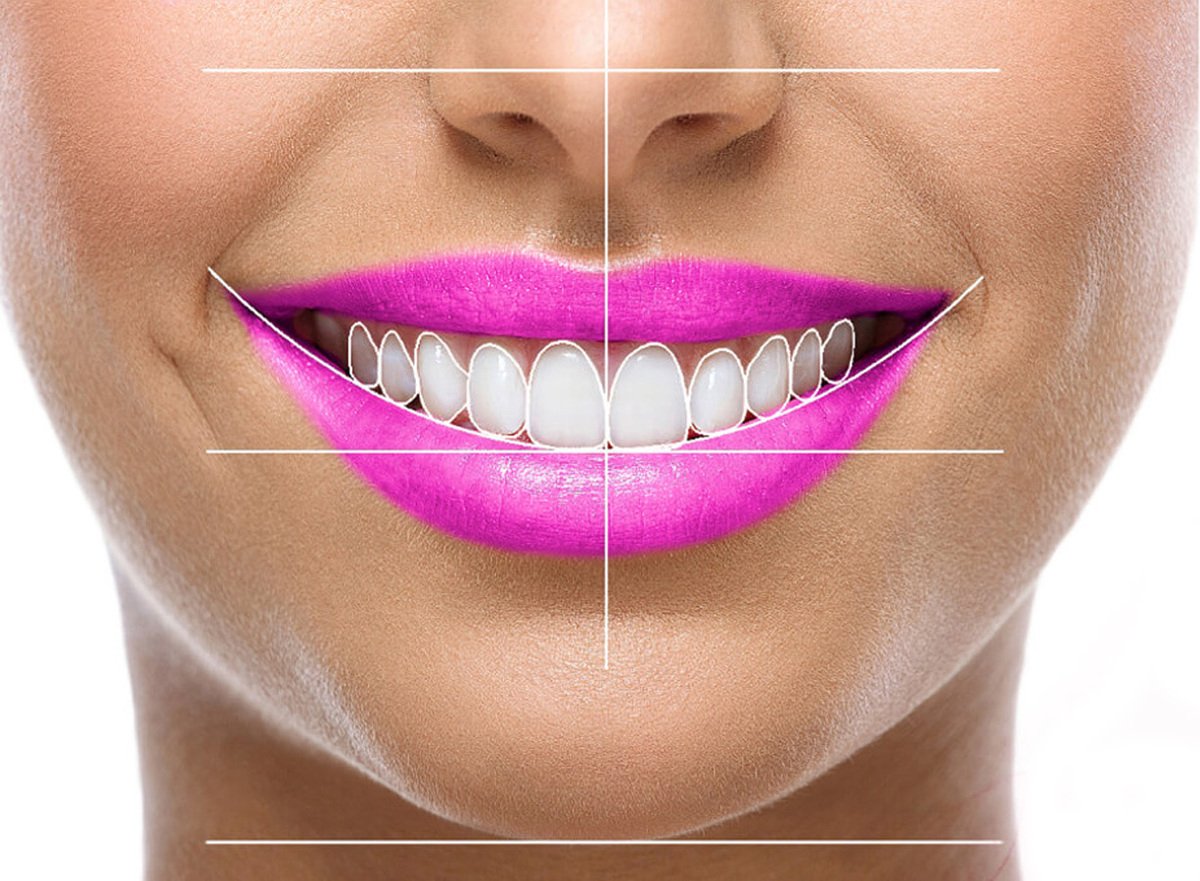 تجربه طراحی لبخند دیجیتال در مطب دندانپزشکی دکتر هومن پاک نیت