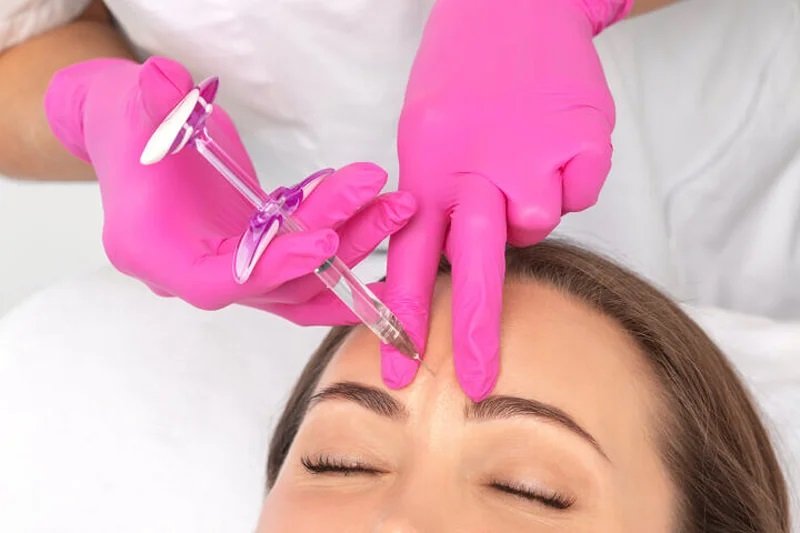 بوتاکس صورت برای تعریق