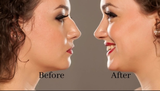 دکتر شفیعی: چگونه ایران به پایتخت جهانی جراحی بینی تبدیل شد؟