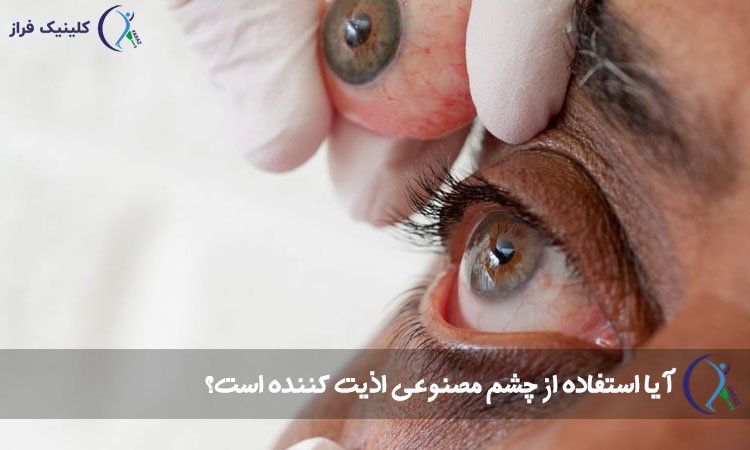 باور های غلط درباره چشم مصنوعی؛ تجربیات و حقایق اصلی را بدانید!