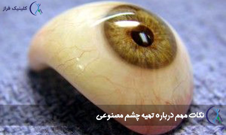 باور های غلط درباره چشم مصنوعی؛ تجربیات و حقایق اصلی را بدانید!
