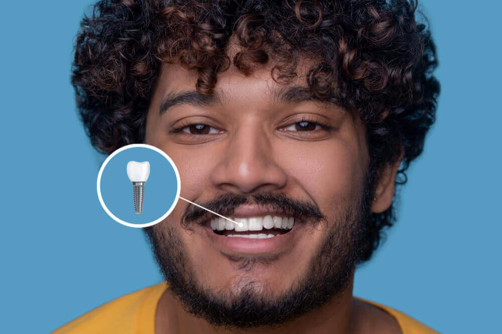 اهمیت متخصص ایمپلنت 3 چه کسانی میتوانند متخصص ایمپلنت دندان باشند ؟
