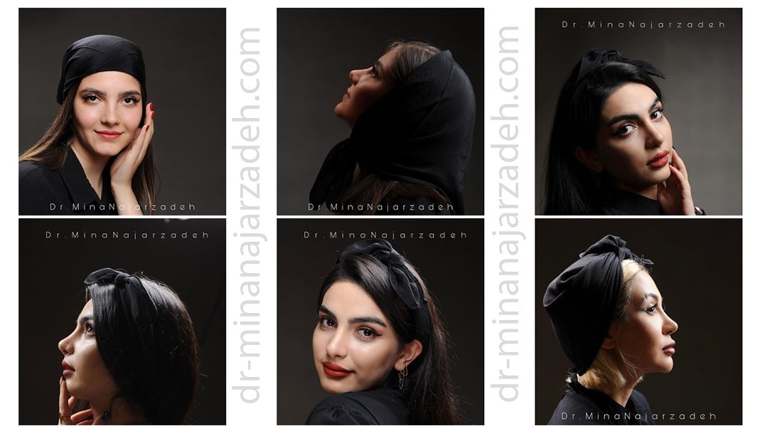 نمونه کارهای جراحی بینی دکتر نجارزاده