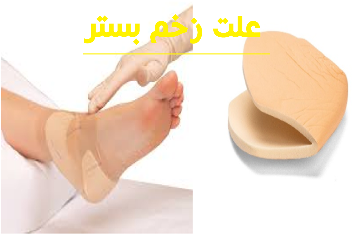 علت زخم بستر