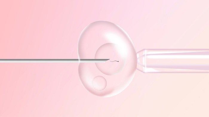 ivf چیست