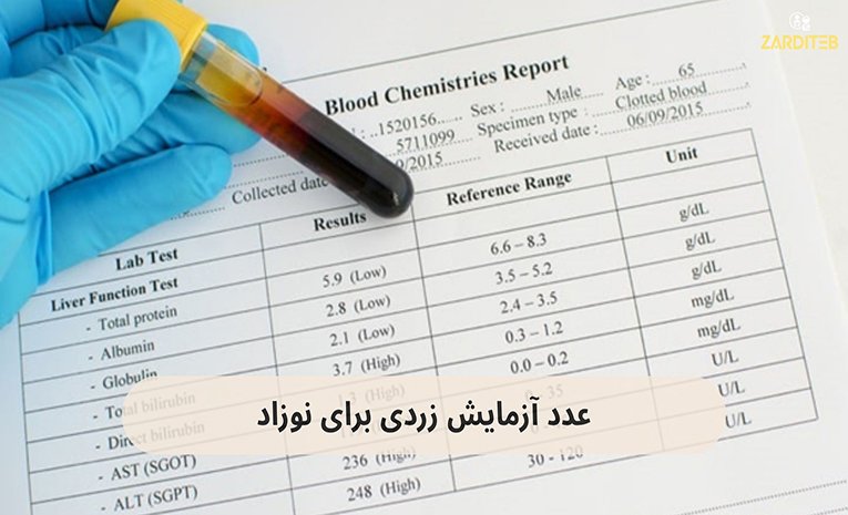 درجه زردی نوزاد