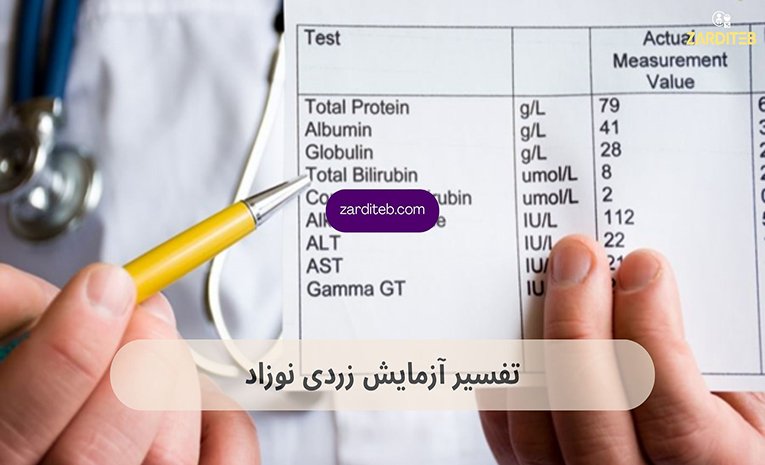 جدول درجه بندی زردی نوزاد