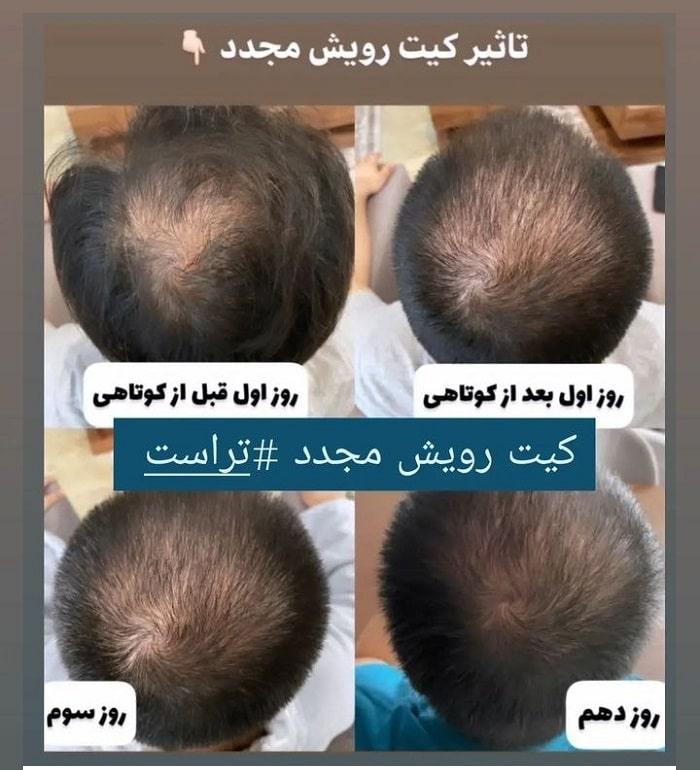 سایت رسمی تراست