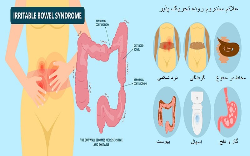 علائم سندروم روده تحریک پذیر