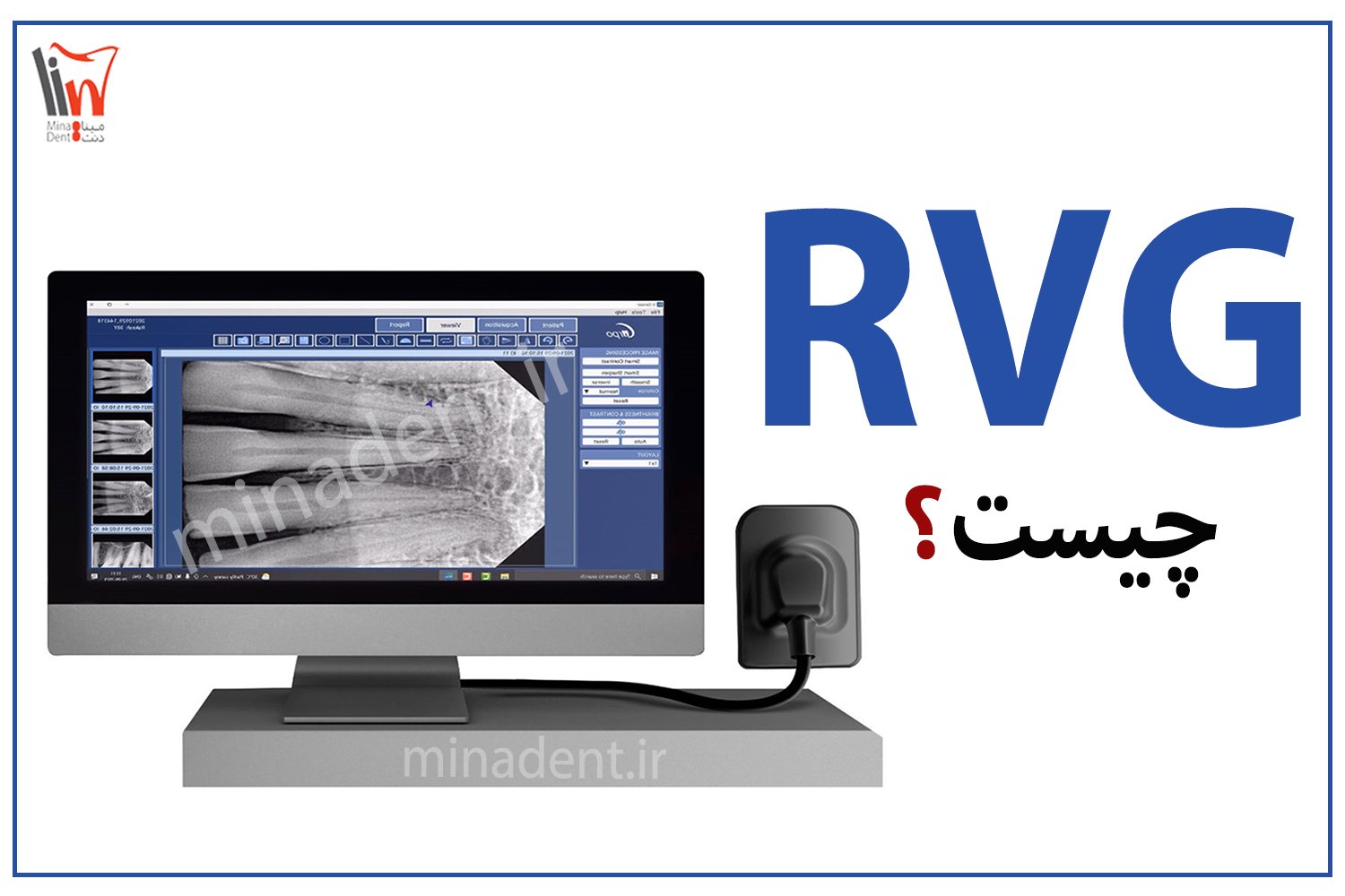 rvg چیست ؟