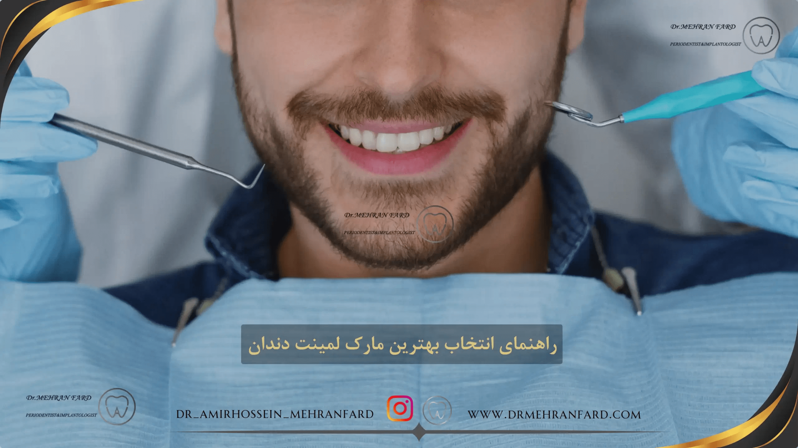 نمونه کارهای  لمینت دندان و کامپوزیت دندان