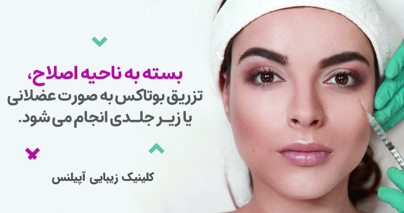 بوتاکس
