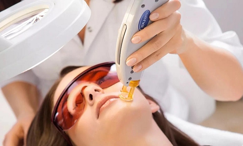 بهترین قیمت دستگاه لیزر موهای زائد 2024 با فروش قسطی ✅ خرید دستگاه لیزر موهای زائد قسطی